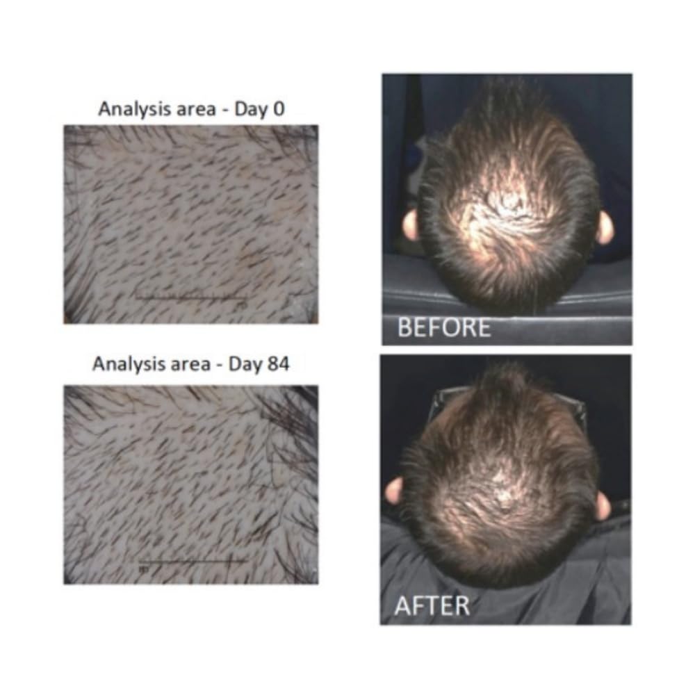 Actsyl-3 hair growth serum texture closeup highlights light, non-oily feel.