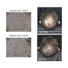 Actsyl-3 hair growth serum texture closeup highlights light, non-oily feel.