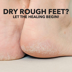 Adamia pineapple enzyme exfoliates rough skin to reveal softer feet.