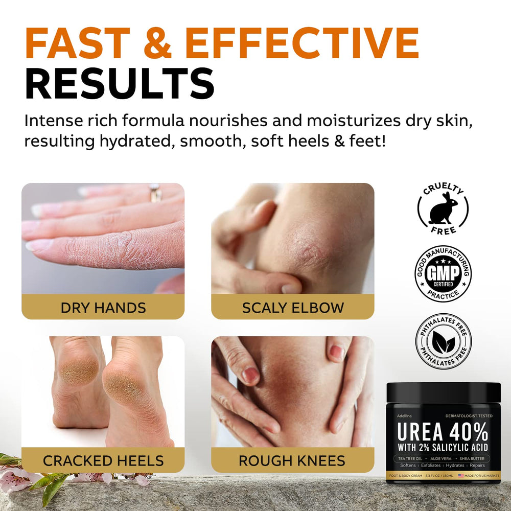 Adellina Urea Cream 40% for cracked heels.