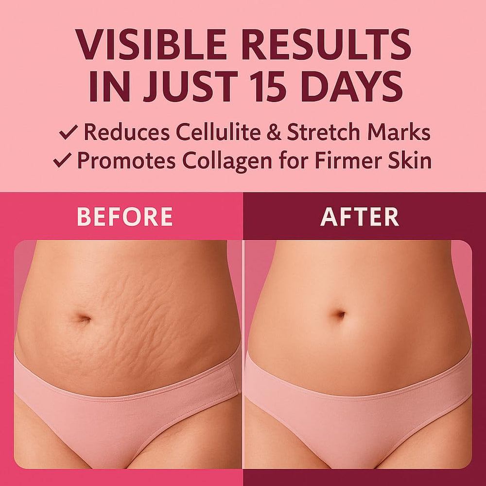 Applying ADEUS Pink Rose Cream to legs for firmer, hydrated skin