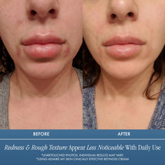 Admire My Skin Potent Retinoid Cream texture swirl reveals silky absorption.