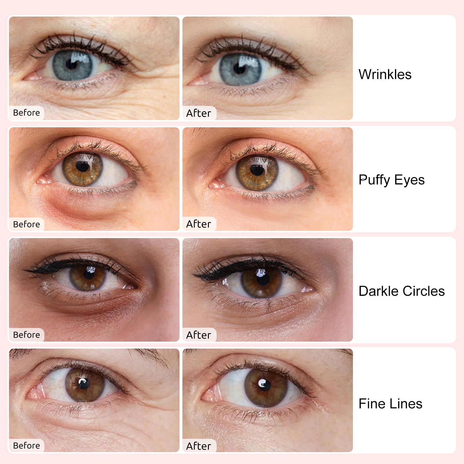 Adofect under-eye patches blue pack presented for possible wrinkle and puffiness support.