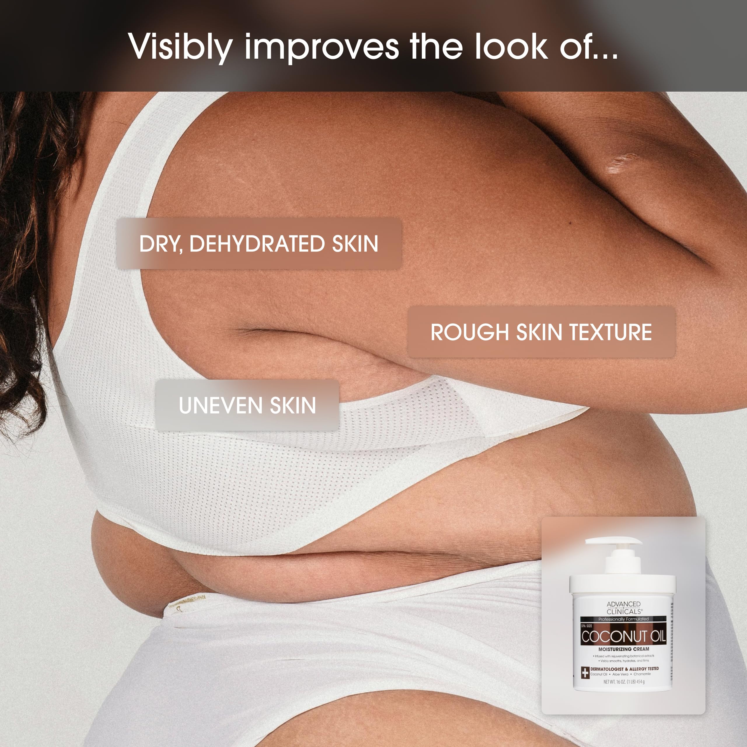 Advanced Clinicals Coconut Oil Body Cream applied to bare skin for softness.