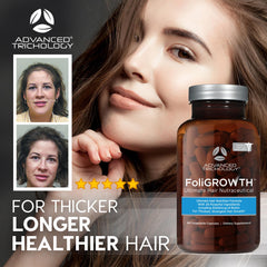 Ingredients scene highlighting Opti MSM and Biotin in FoliGROWTH.