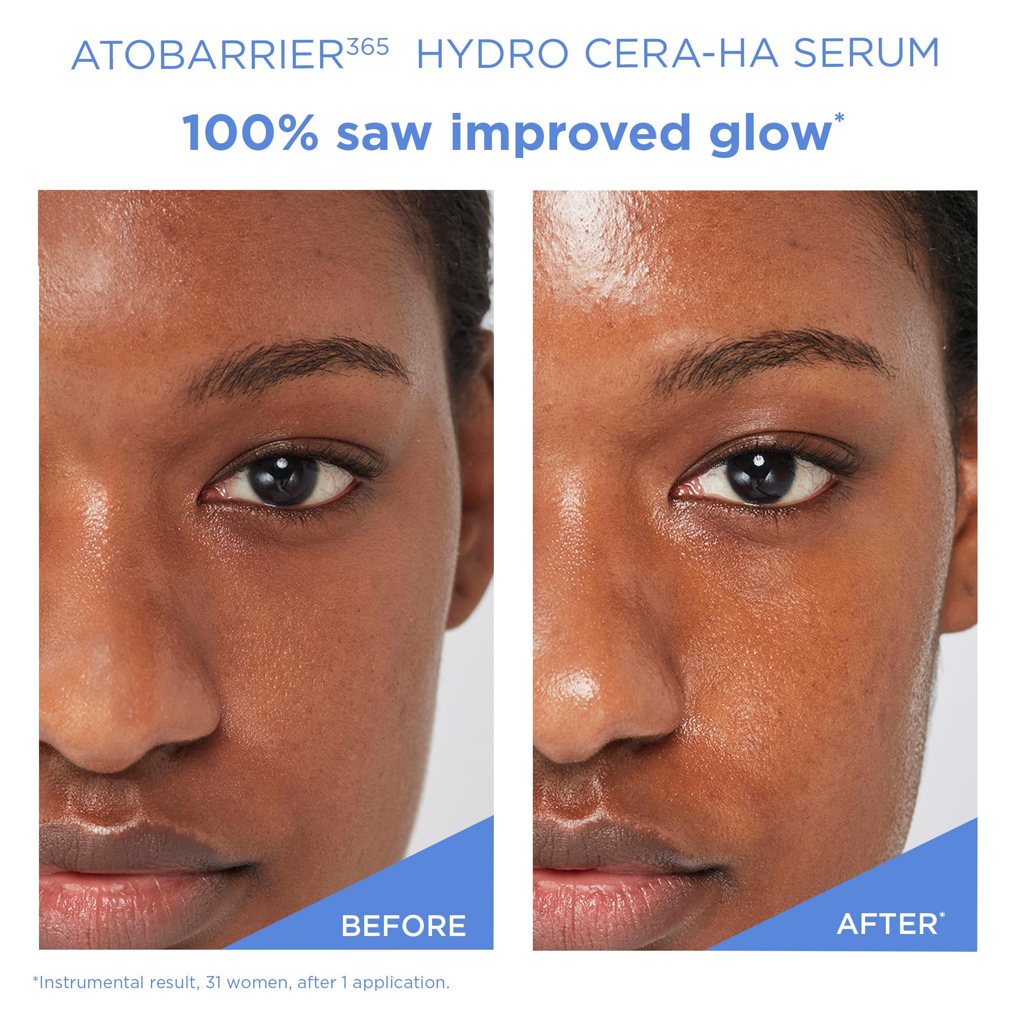 AESTURA ATOBARRIER365 glycerin and niacinamide nourish the barrier.