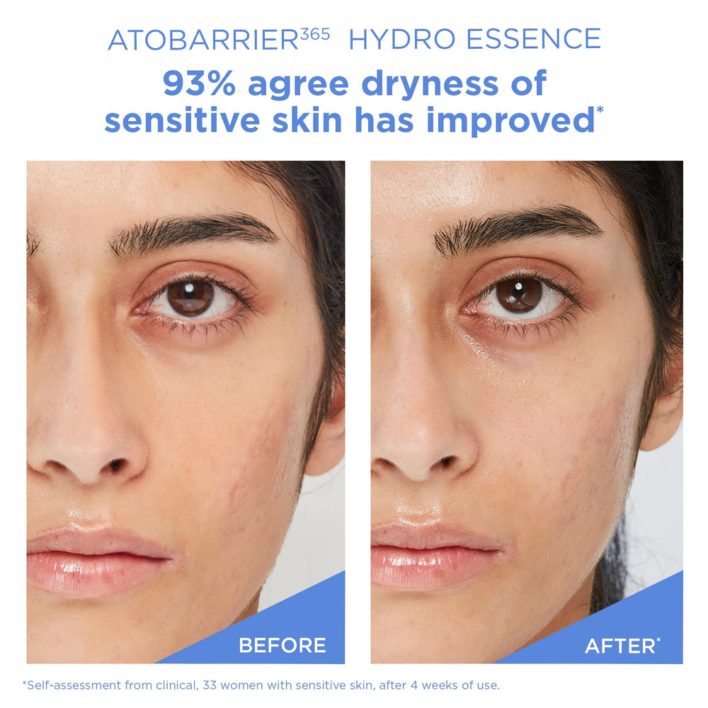 AESTURA ATOBARRIER365 Hydro Essence closeup-label highlights fragrance-free, derm-tested safety