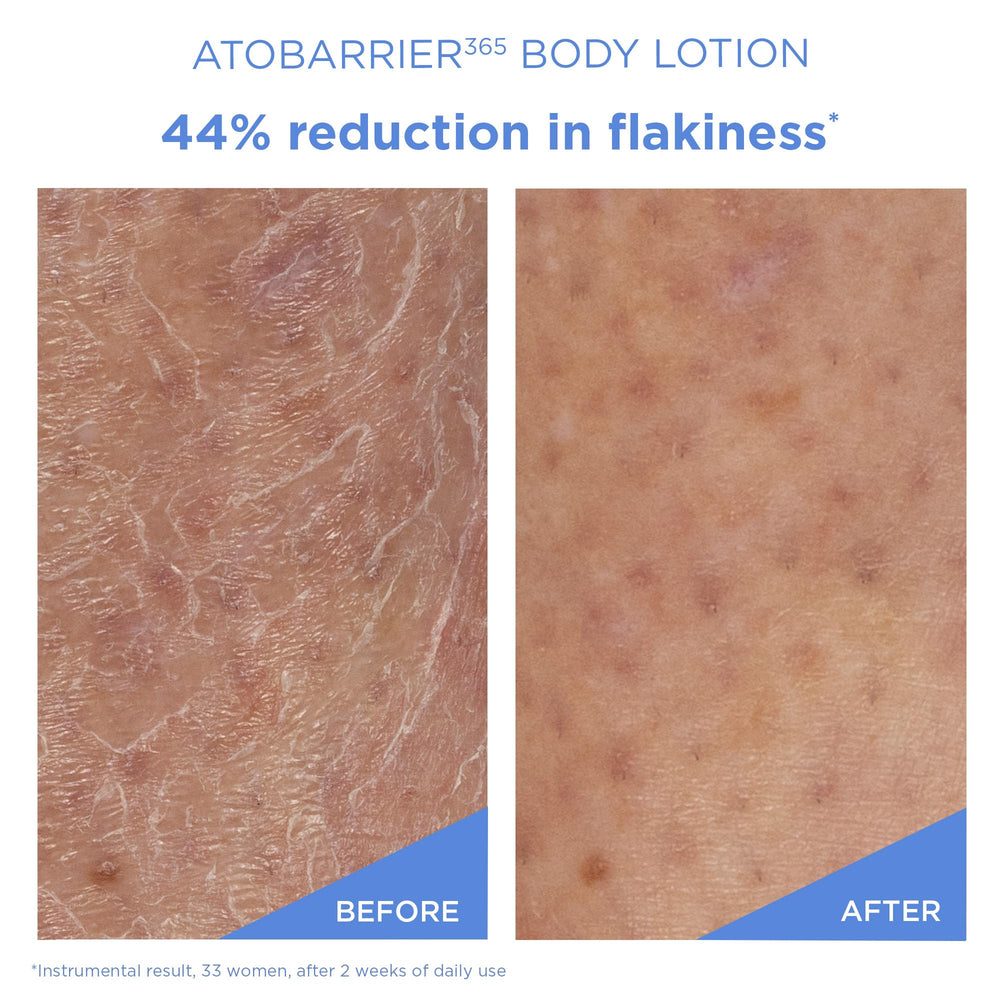 AESTURA ATOBARRIER365 rich with vitamin E, panthenol and glycerin for hydration.