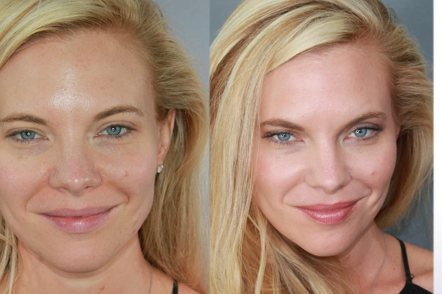 Ageless Derma Dover Beige shade on skin for even tone