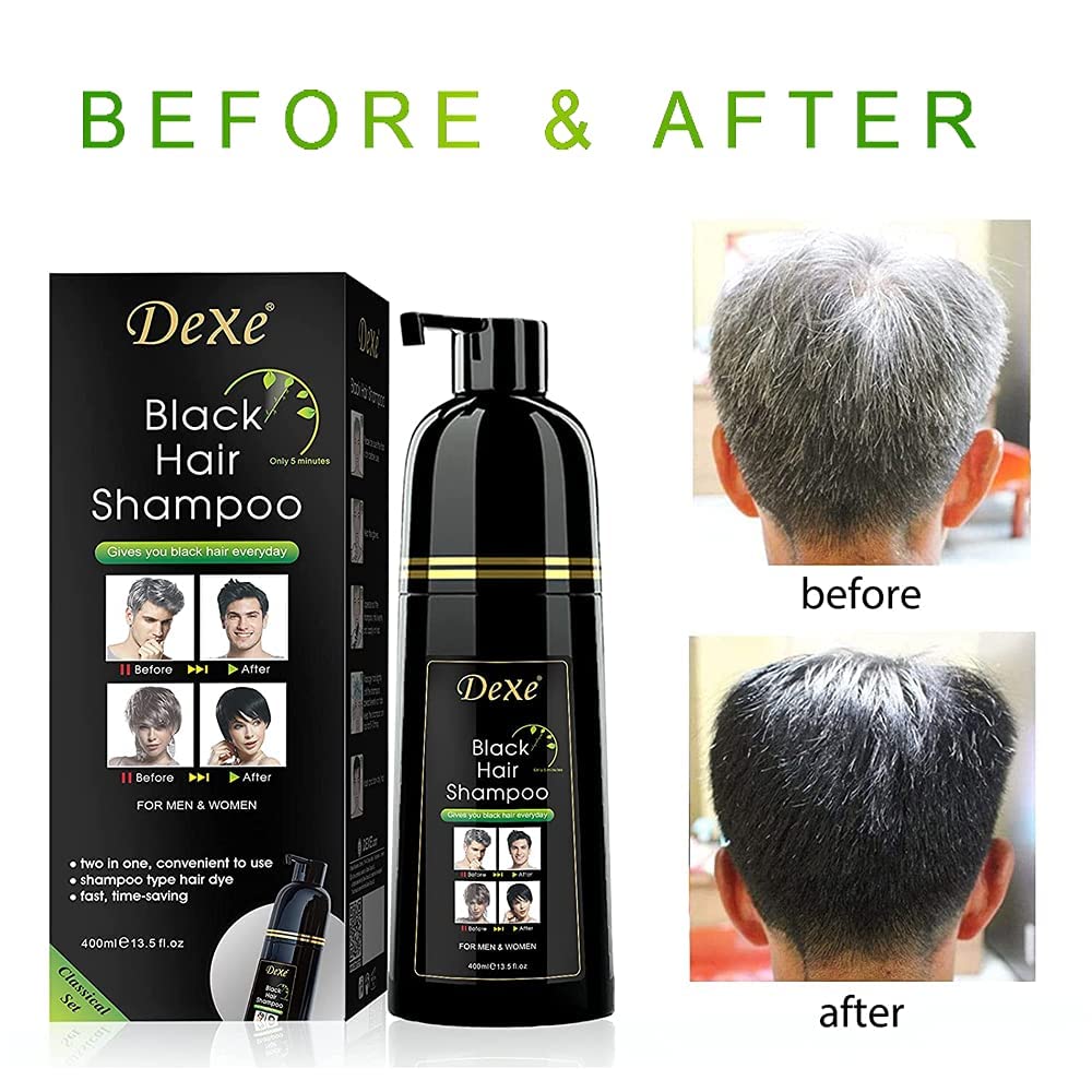 Agthyuve Dexe gray hair coverage result with solid black shade
