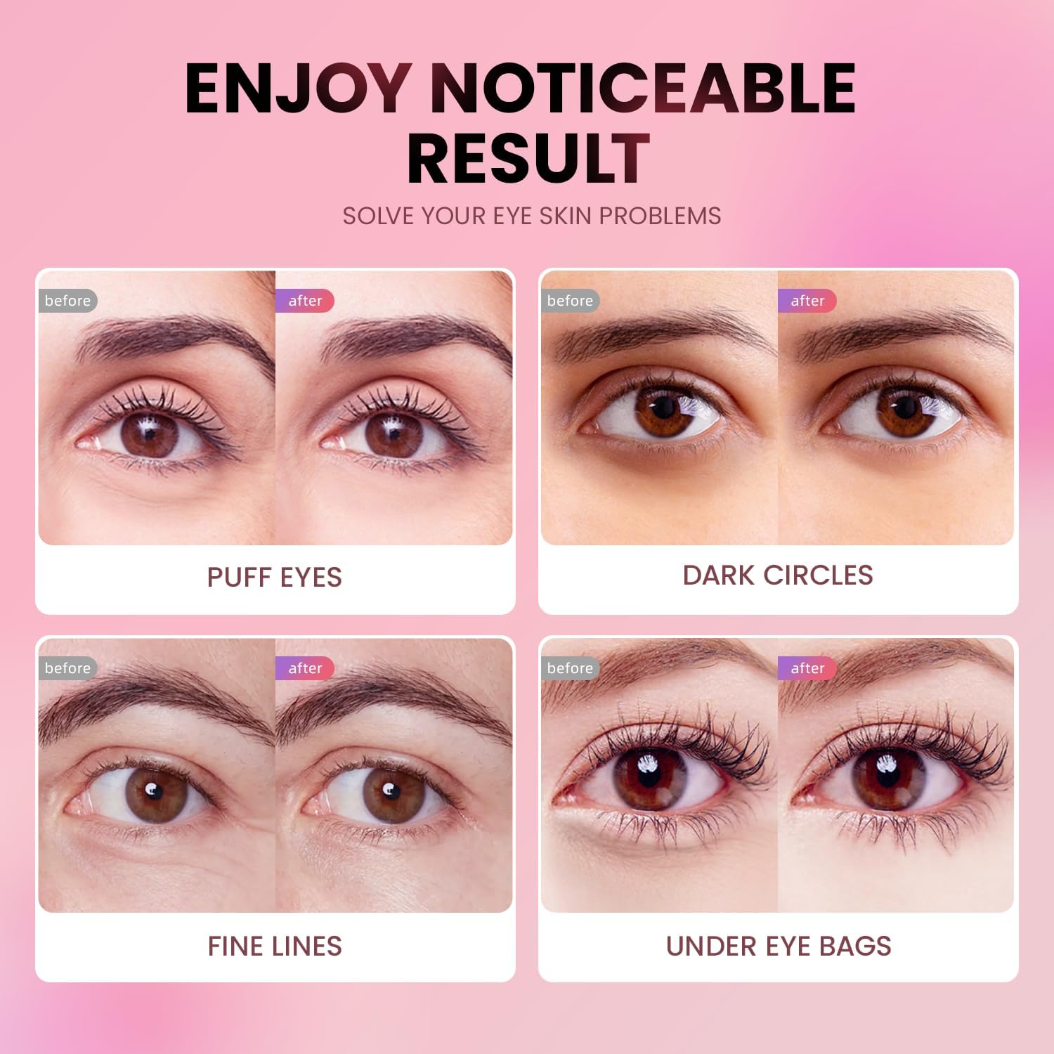 AILEORY caffeine-infused patches near the eye reduce puffiness visually