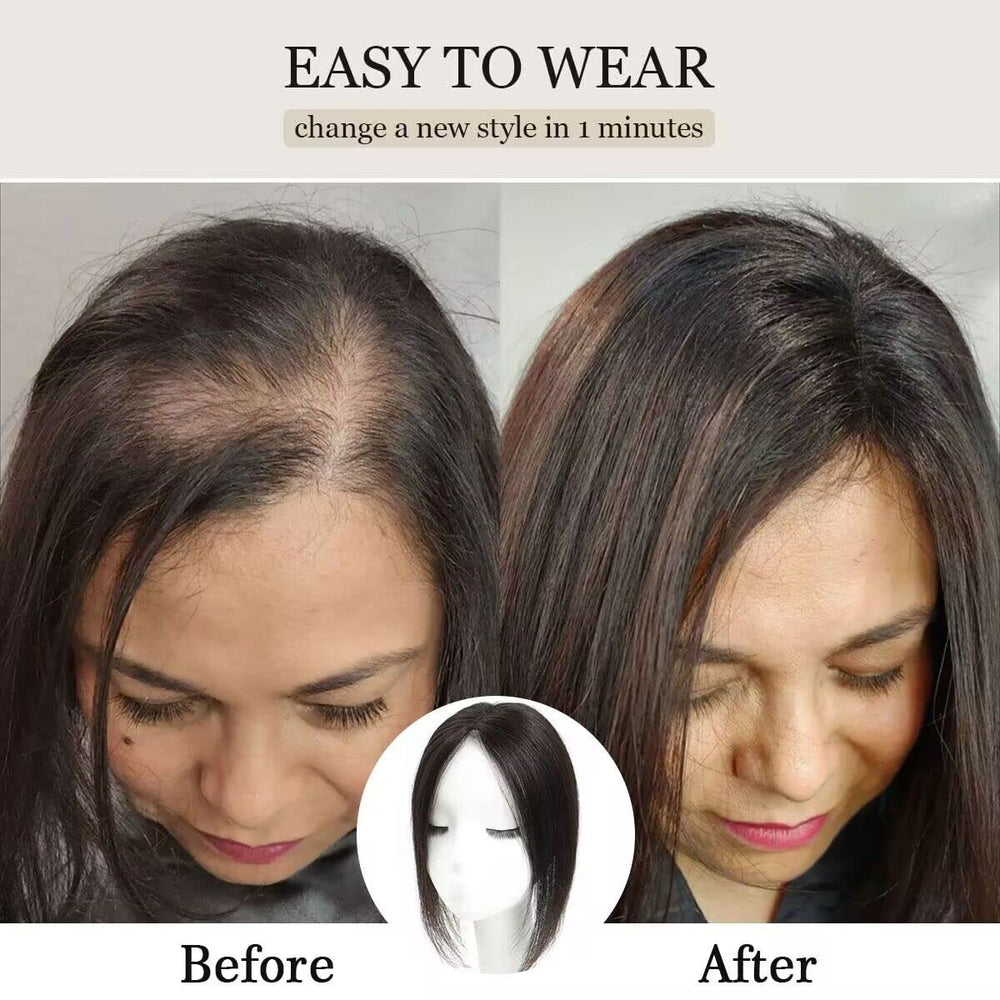 Aimeolyn topper front hairline appears natural and undetectable.