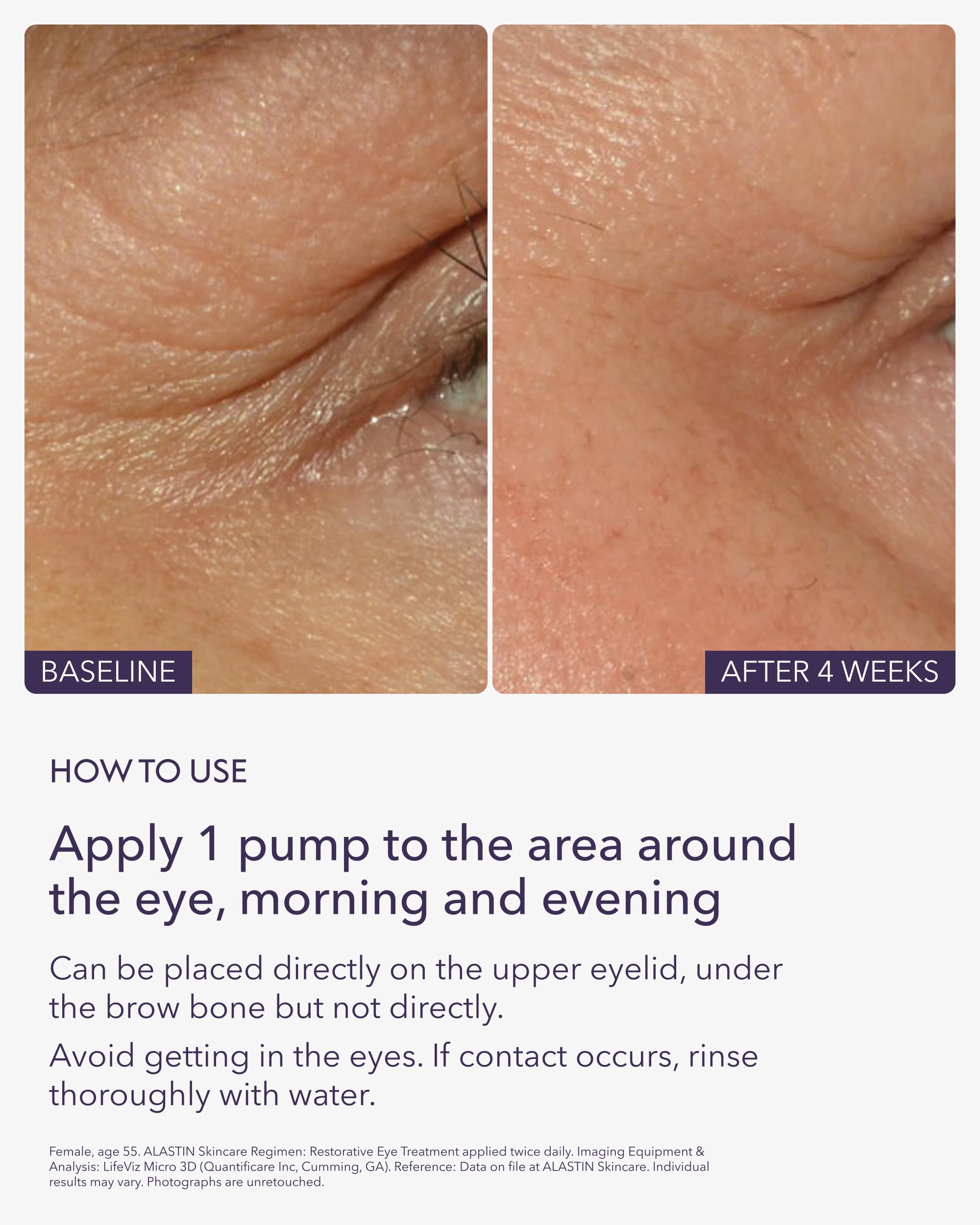 ALASTIN Restorative Eye Treatment under-eye application demonstrates gentle, quick absorption