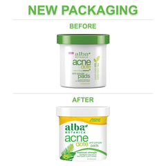 Alba Botanica AcneDote pads with witch hazel and thyme extract.