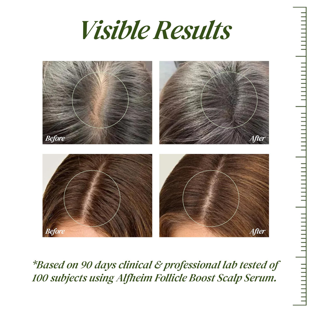 ALFHEIM serum applicator delivers precise root treatment for mess-free application.
