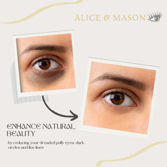Alice & Mason golden eye patches resting softly on skin under eyes