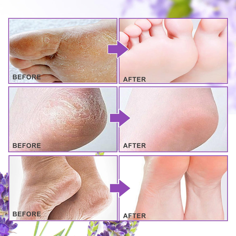 Feet with mask applied on ALIVER product, close-up of application.