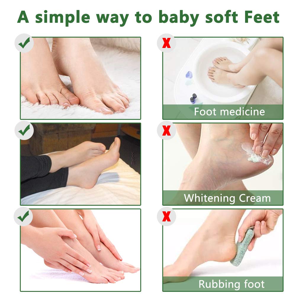 ALIVER Foot Peel Mask 3-pack gift-friendly spa experience for loved ones