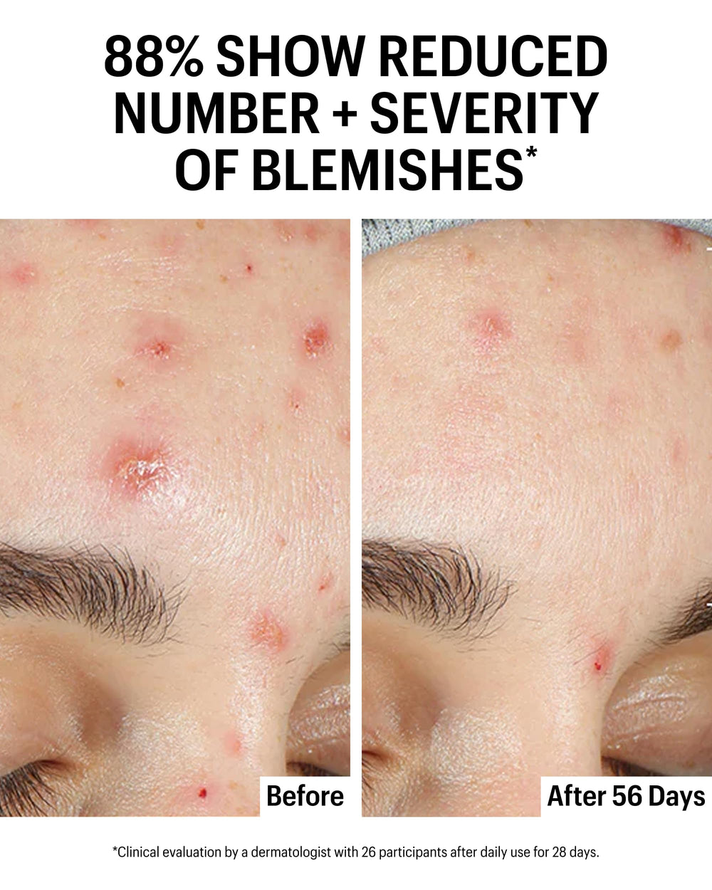 Kojic, Bakuchiol, and Licorice complex portrayed as calming skin support.