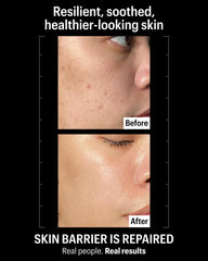 Allies of Skin Molecular Barrier Cream Balm being applied at night for soothing recovery and moisture retention.