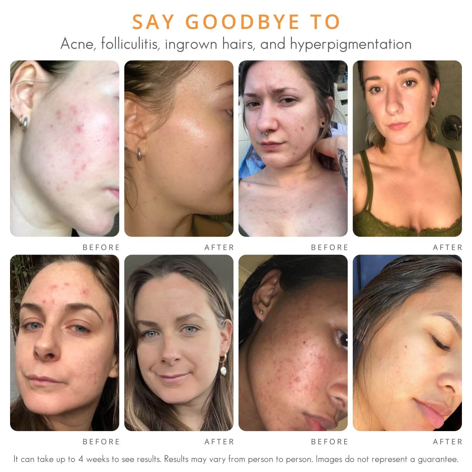 Almond Clear fine-lines close-up conveys potential for smoother, youthful-looking skin.