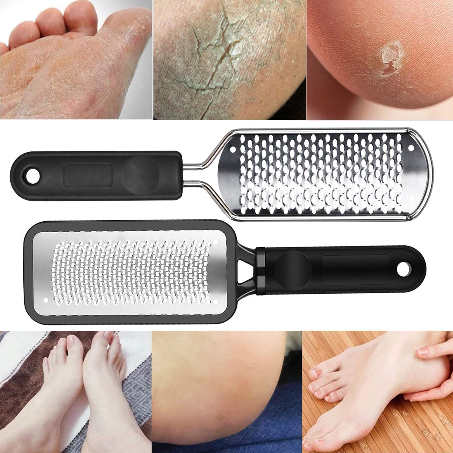 ALOCKMA professional pedicure tools deliver salon-like results at home.