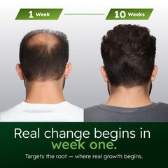 Alphainfuse bottle label closeup emphasizing premium scalp care.