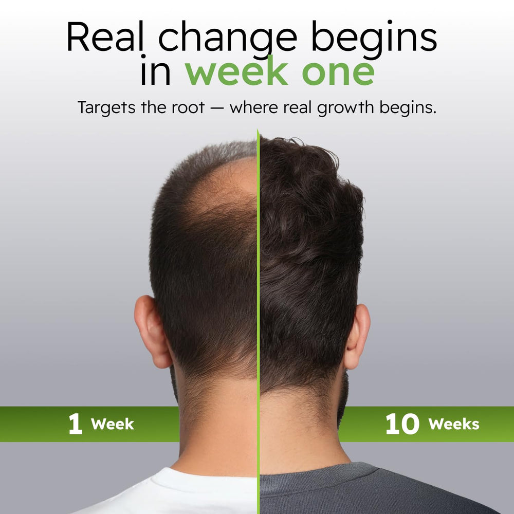 Alphainfuse Panax ginseng and Eclipta Prostrata extracts seen for healthier-looking scalp.