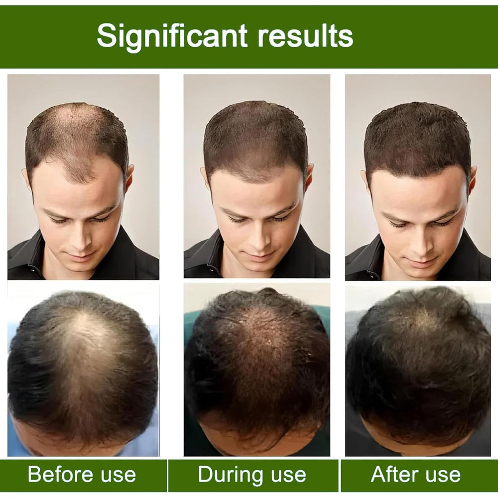 AlphainFuze peppermint oil image hints at refreshing scalp sensation.