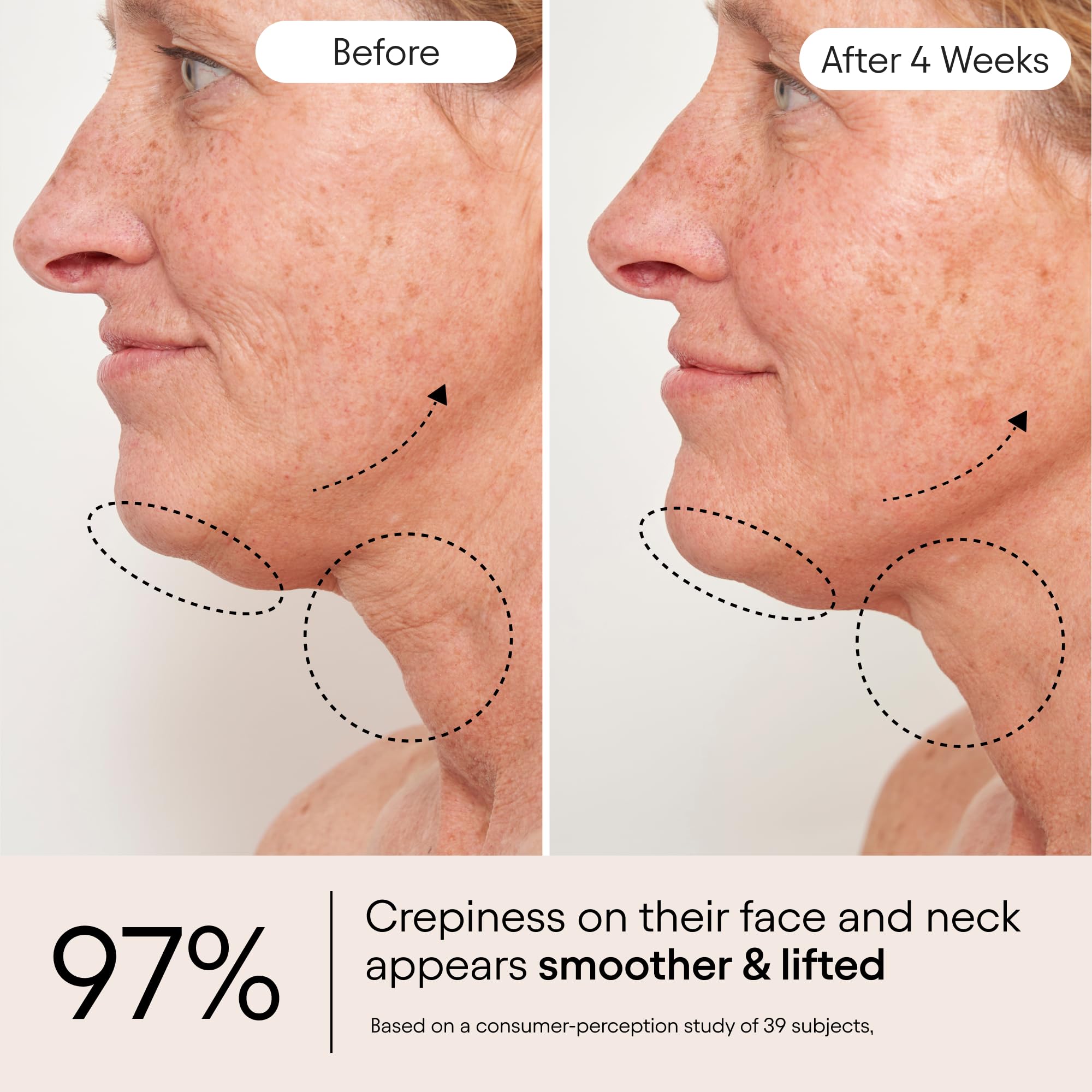 Alpyn Beauty Apple fruit extract visual signals natural texture improvement.