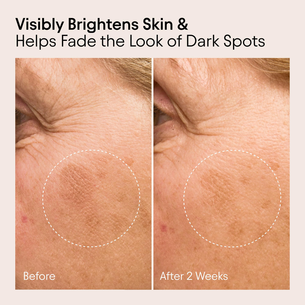 Alpyn Beauty Bearberry and Vitamin C ingredients close-up suggesting brightening potential.
