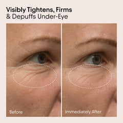Alpyn Beauty Line-Filling Eye Balm ingredients highlighted: Bakuchiol, caffeine, and algae.
