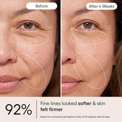Alpyn Beauty Snap8 peptide label detail highlighting wrinkle relaxation potential