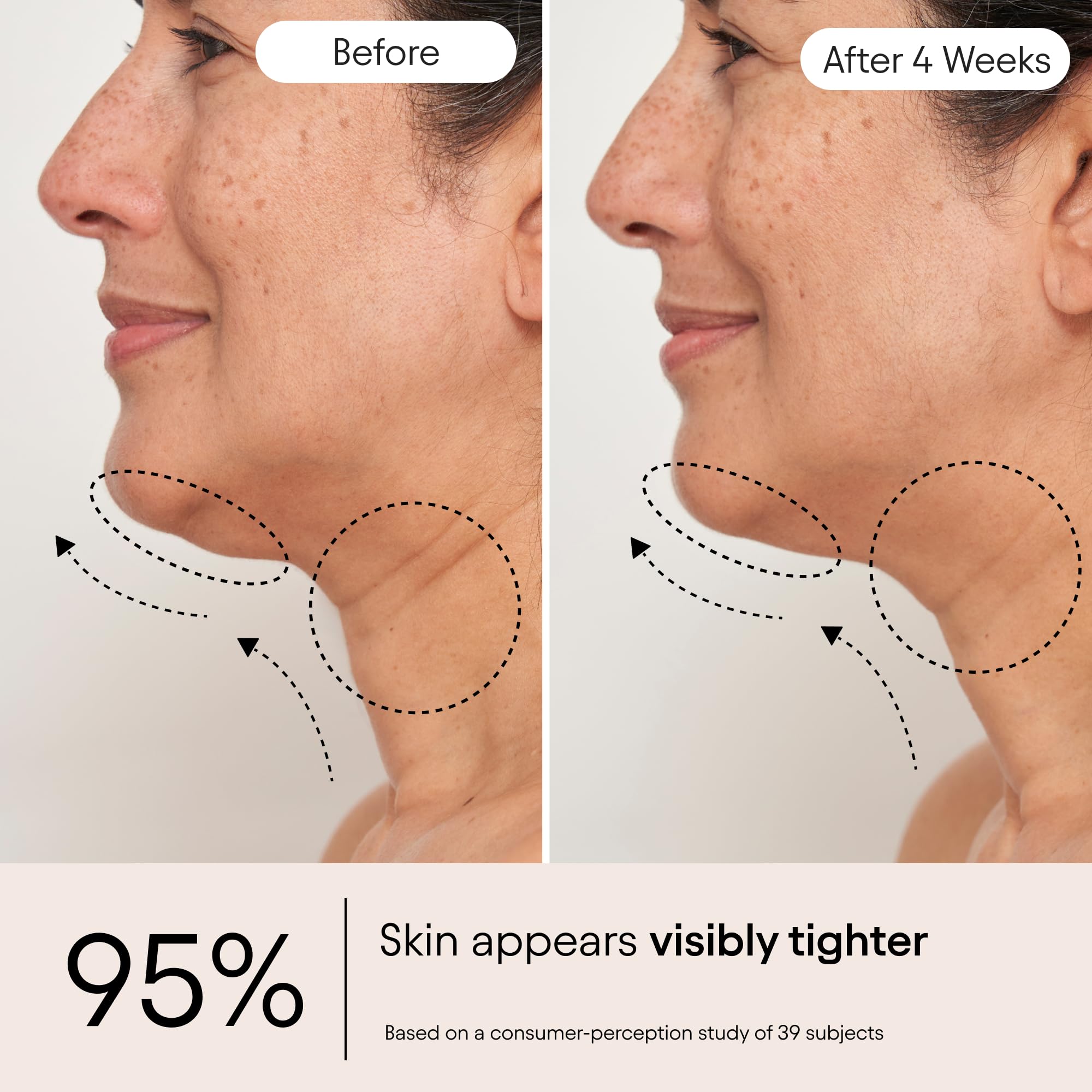 Alpyn Beauty Super Sculpt Serum applied on the face and neck for sculpted look.