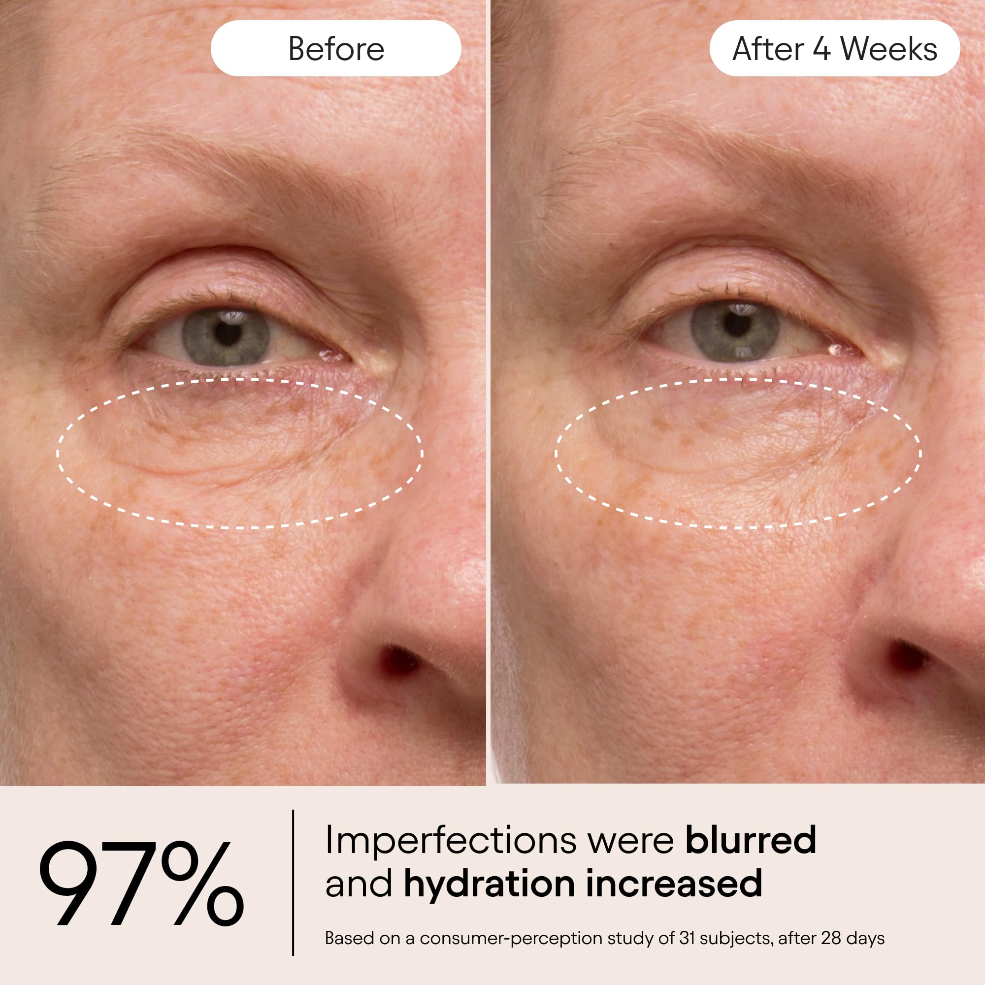 Alpyn Beauty Instant Bright Eye application shot highlights gentle under-eye care.