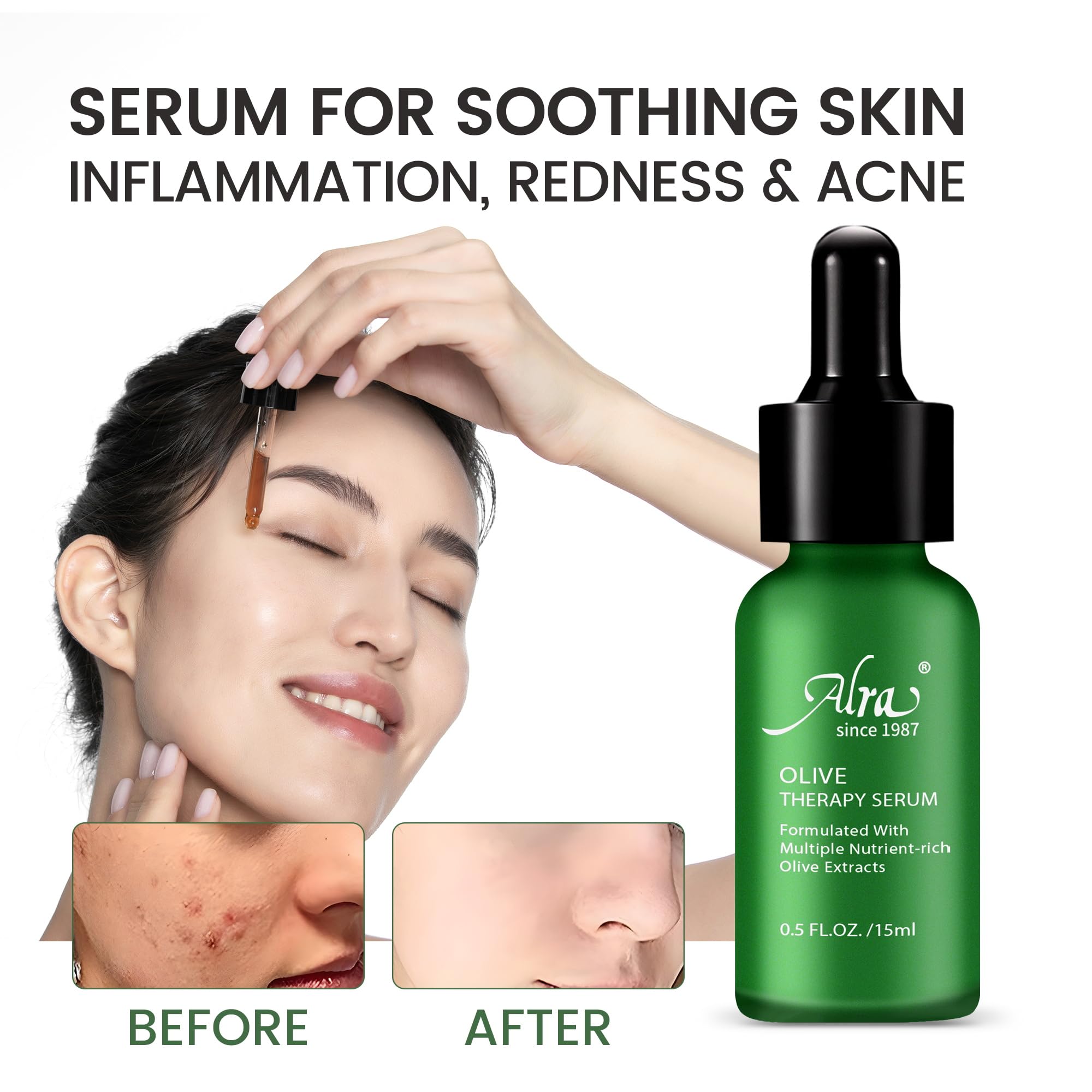 Serum applied to acne-prone areas for clearer-looking skin