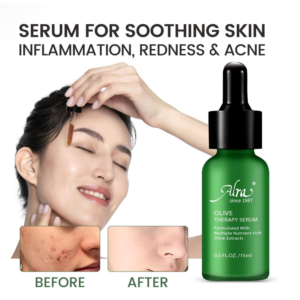 Serum applied to acne-prone areas for clearer-looking skin