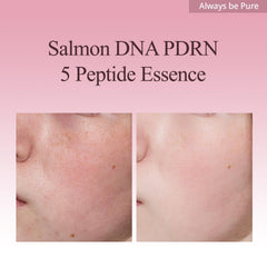 Always Be Pure Mela-PDRN serum close-up shows quick absorption.
