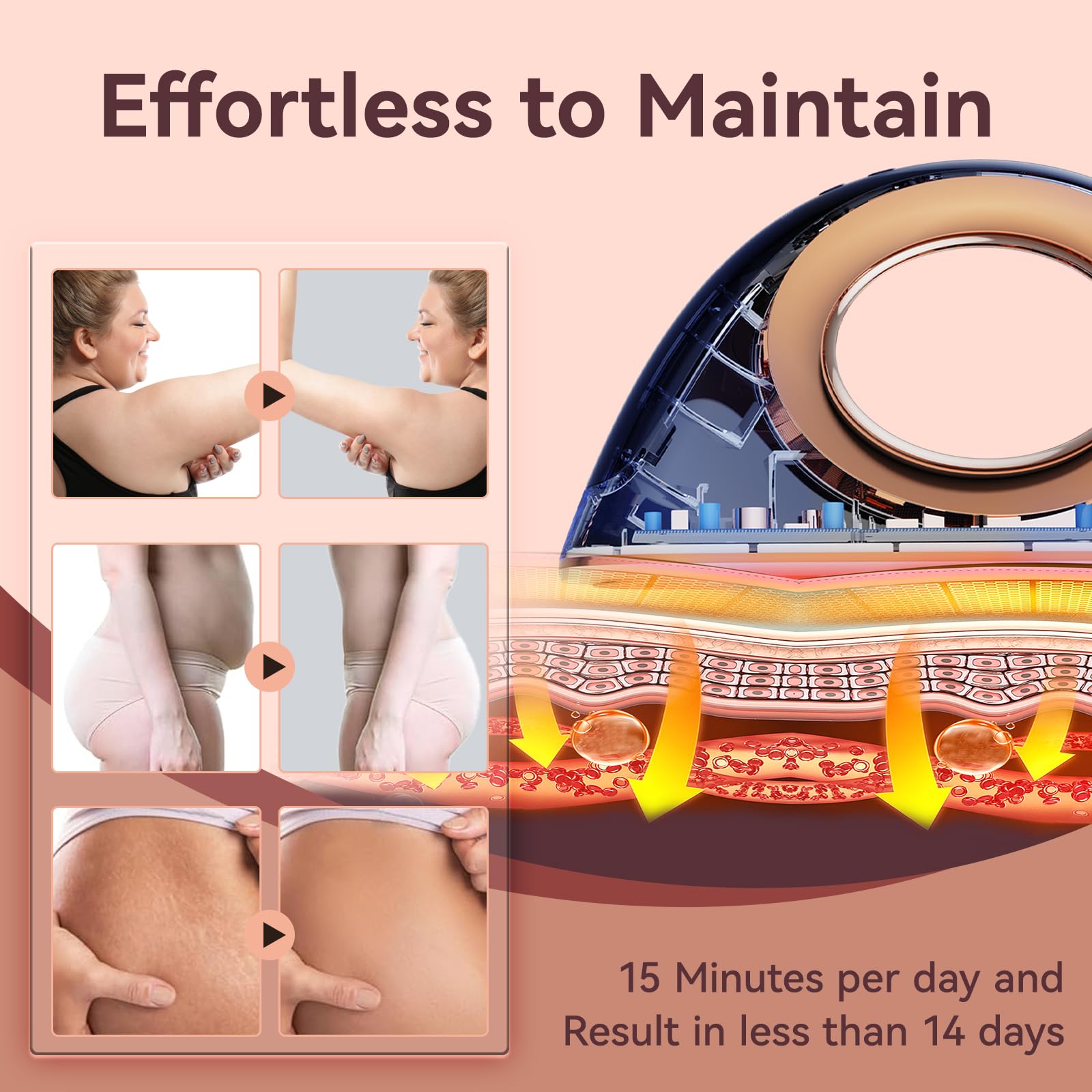 AMZPMBUY device tackles belly rolls with non-thermal RF and massage.