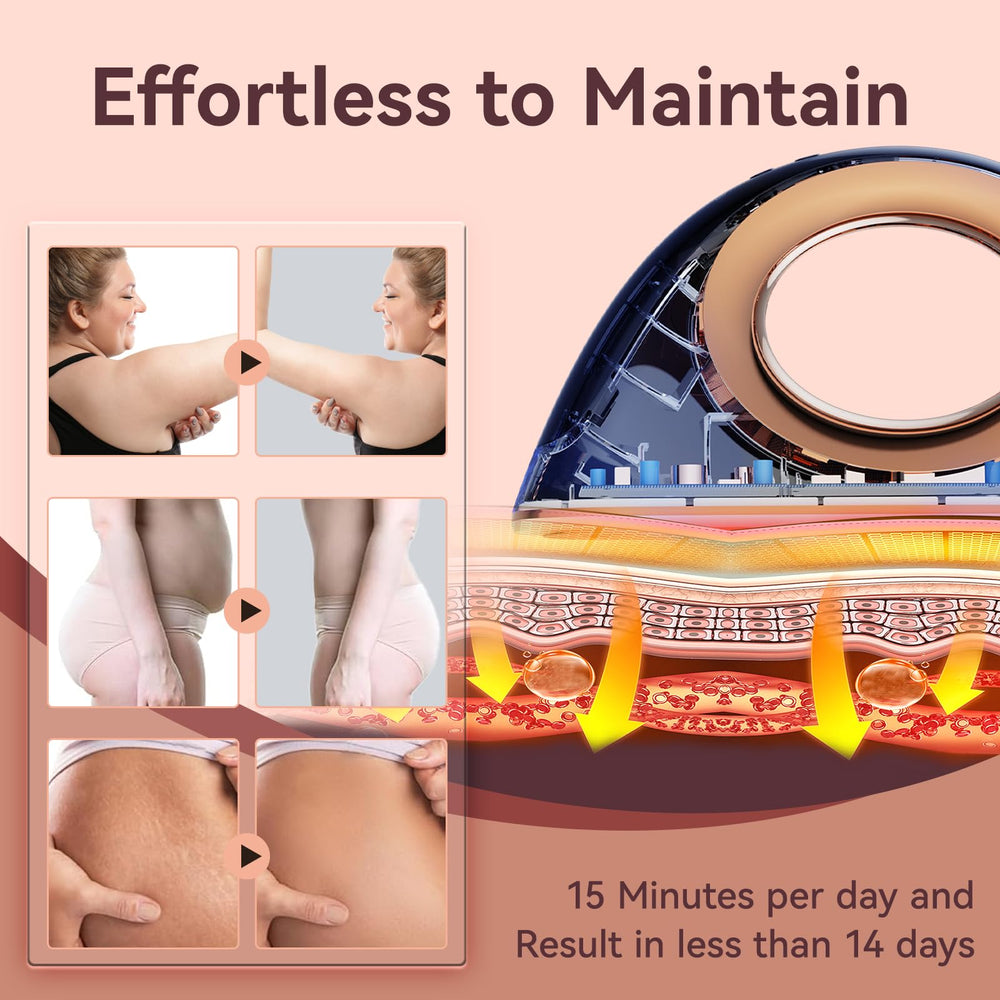 AMZPMBUY device tackles belly rolls with non-thermal RF and massage.