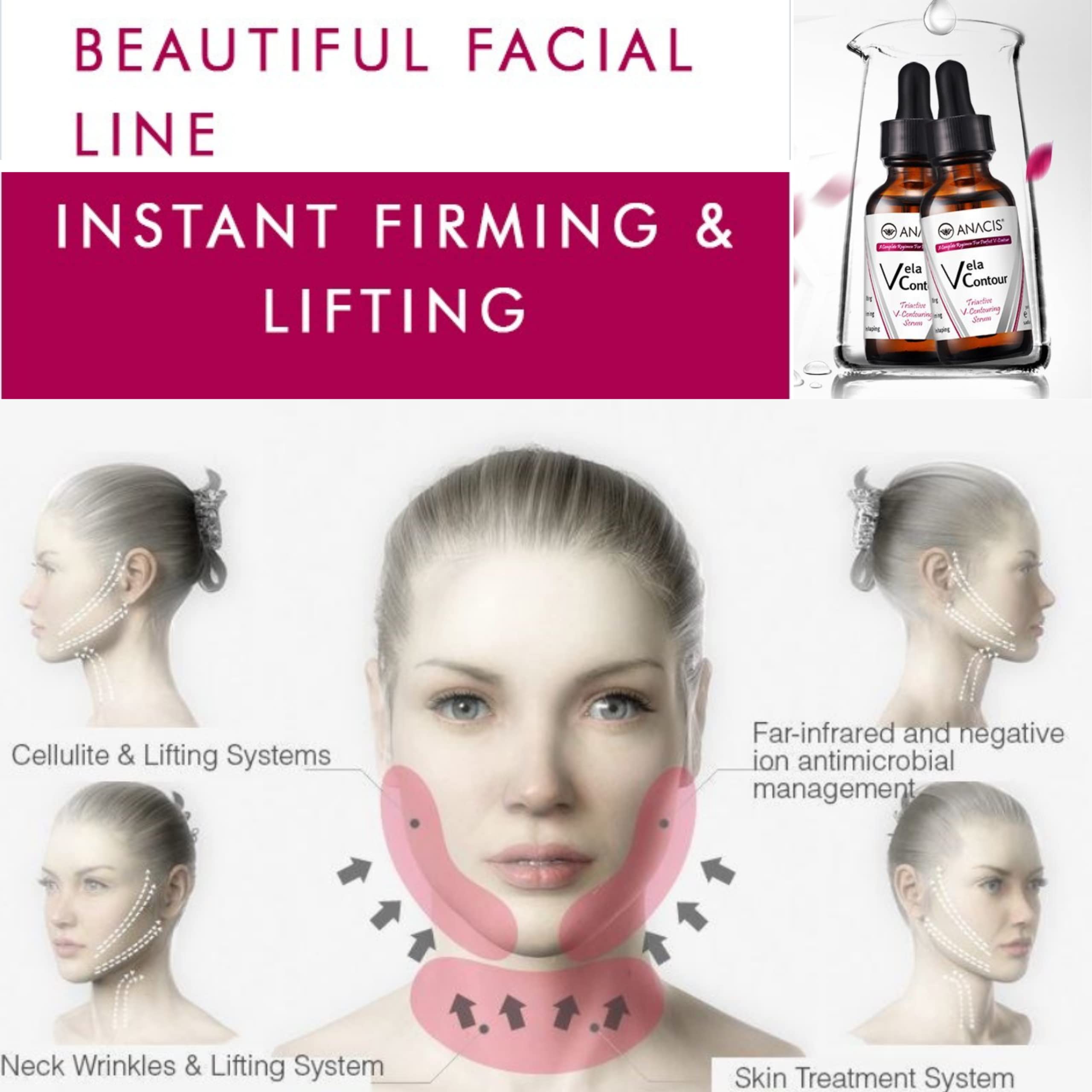 Application near the V-line to define the neckline with Anacis serum