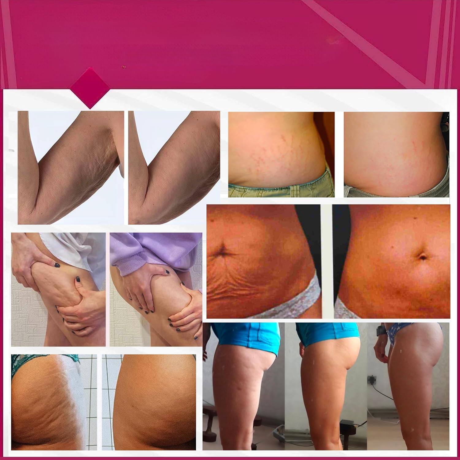 Anacis skin firming application visual emphasizes lifted, resilient skin after use.