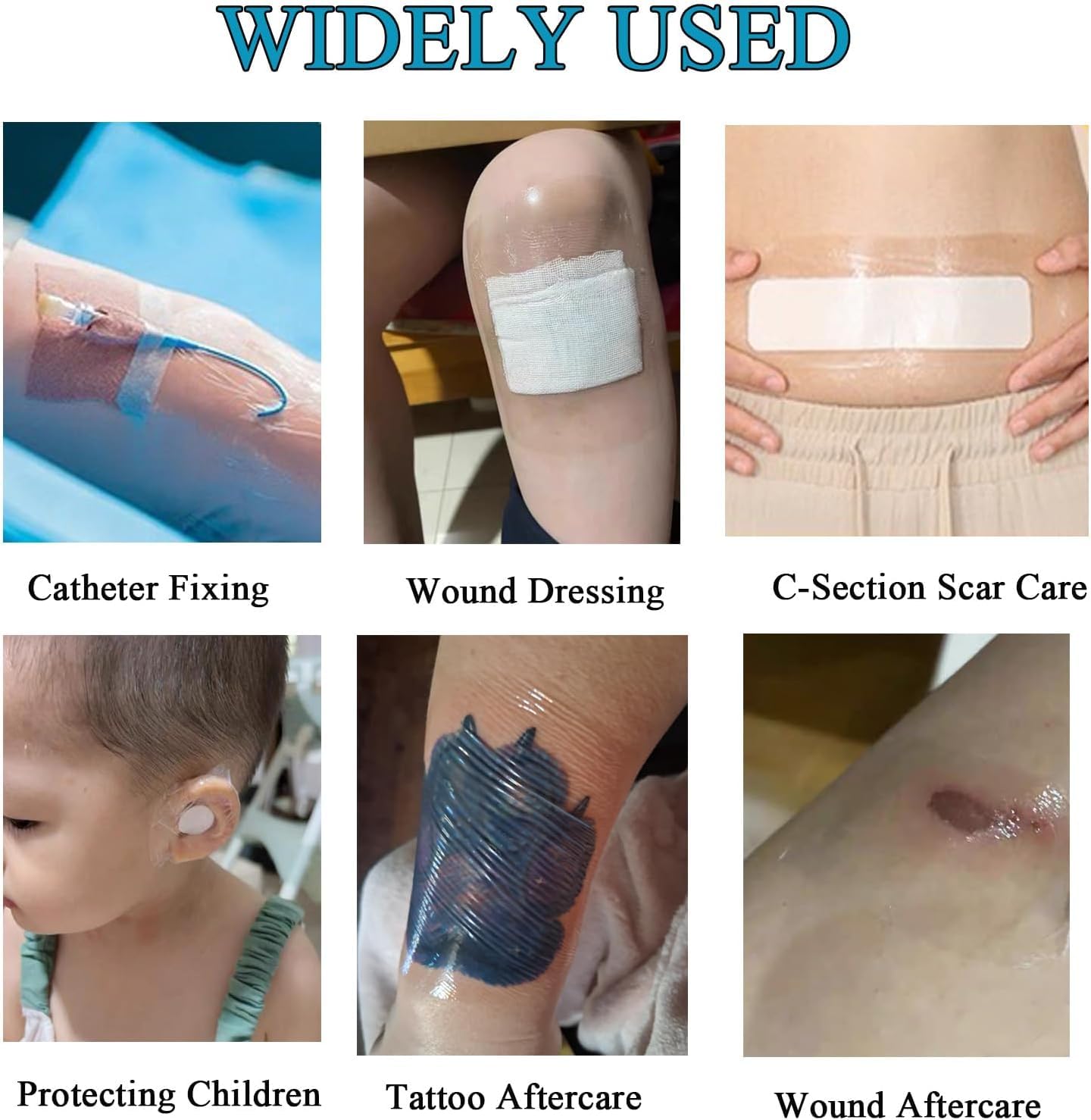 ANAMPION hypoallergenic adhesive bandage on arm gentle on skin