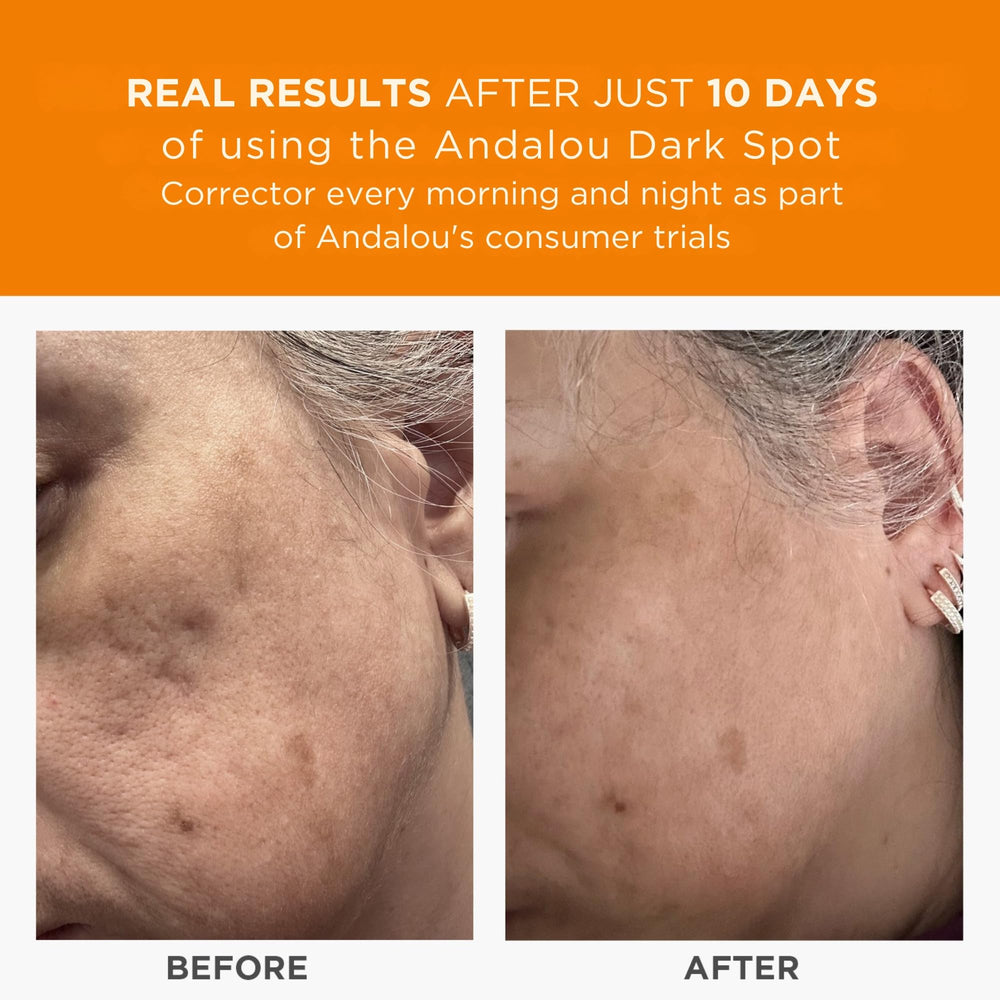 Andalou Naturals – application matin et soir sur le visage.