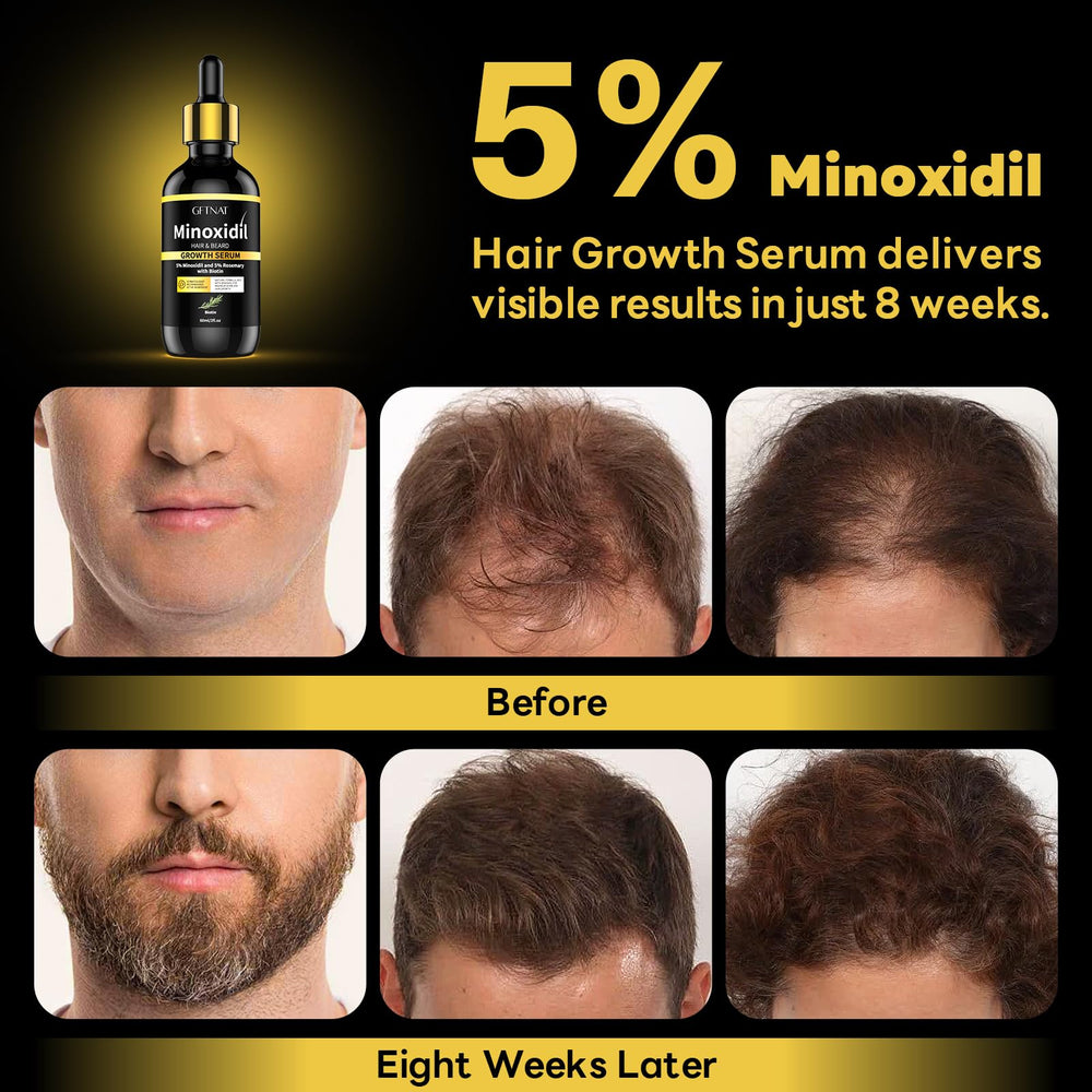 Andelusita minoxidil serum on skin with quick-absorb texture