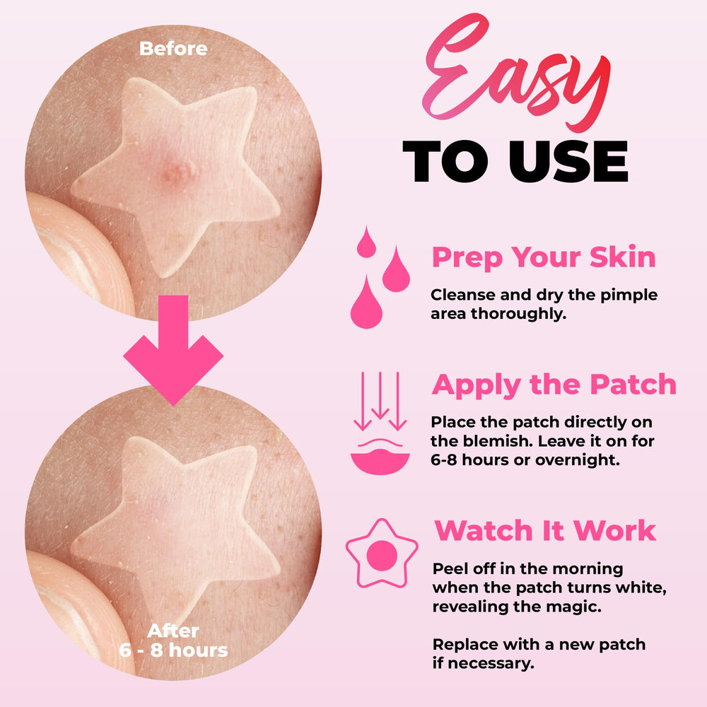 Andlane heart patches offer gentle blemish care with a cute touch for daytime wear.
