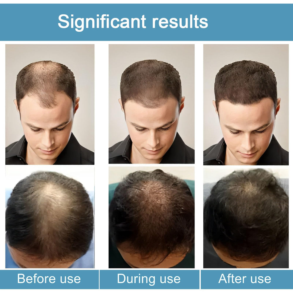 Ginseng extract component shown to support the formula for thicker-looking strands.
