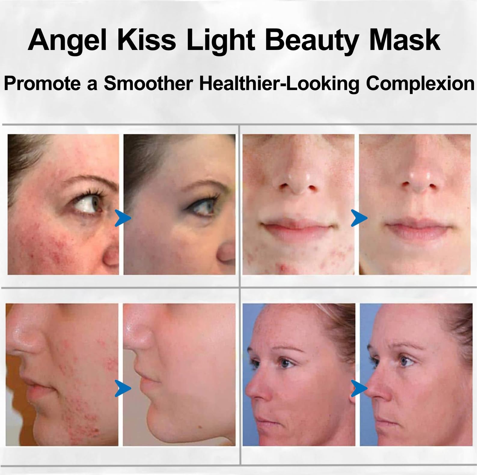 Angel Kiss LED bulbs closeup highlighting high-purity light for gentle treatments.