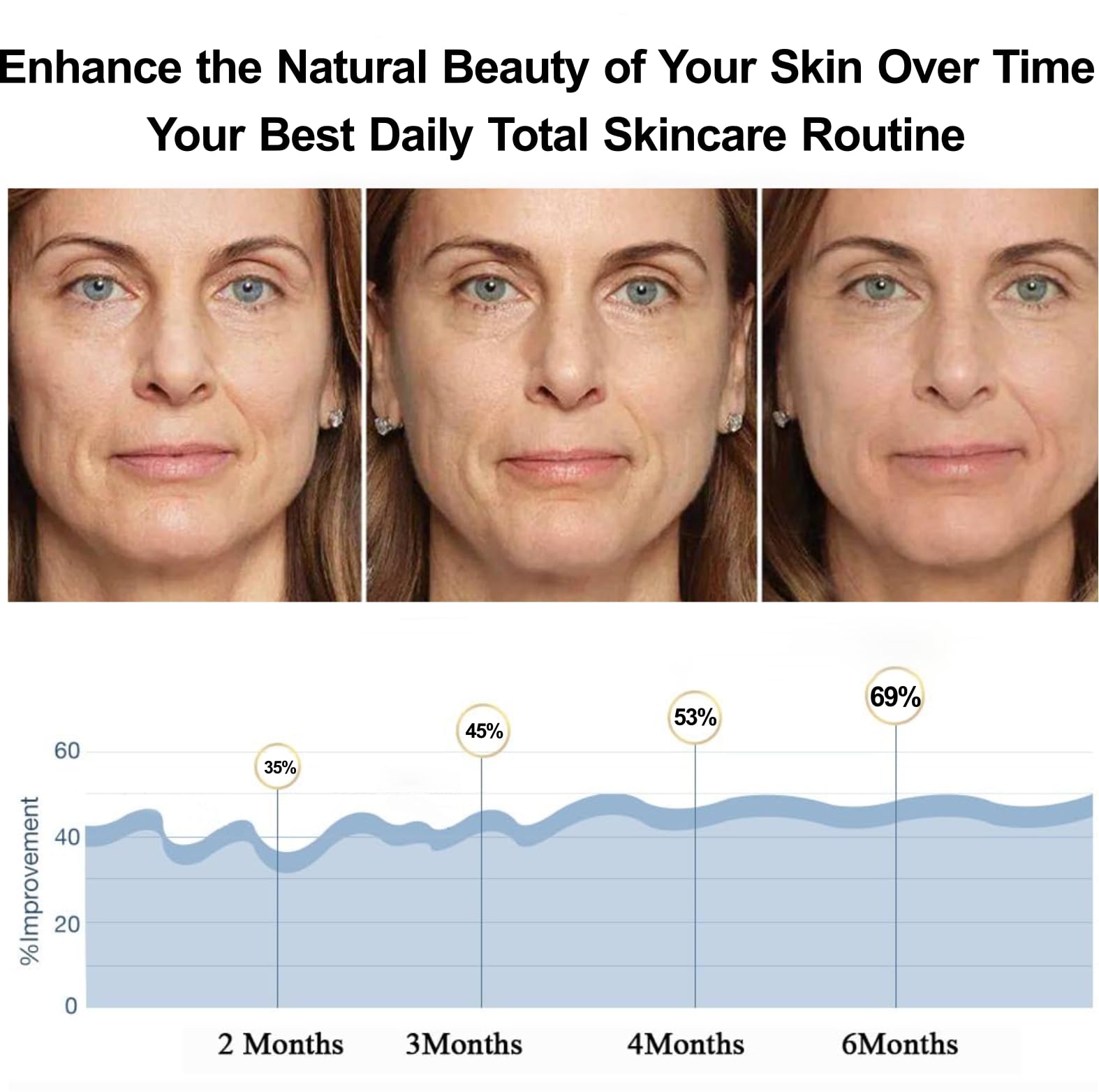 Angel Kiss Red Light Therapy Face image emphasizing non-invasive skincare at home.