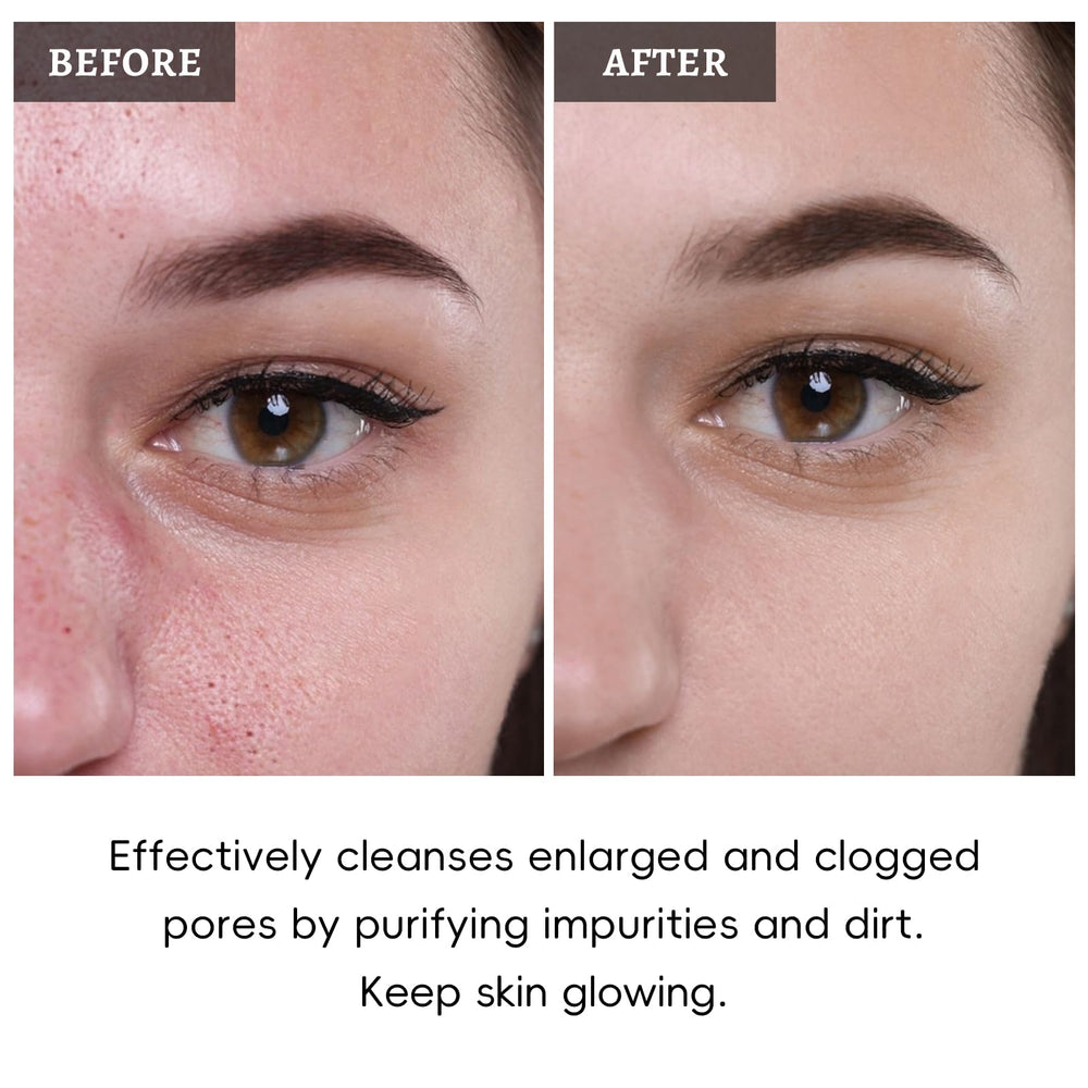 ANRCOLLECT formula safe for all skin types
